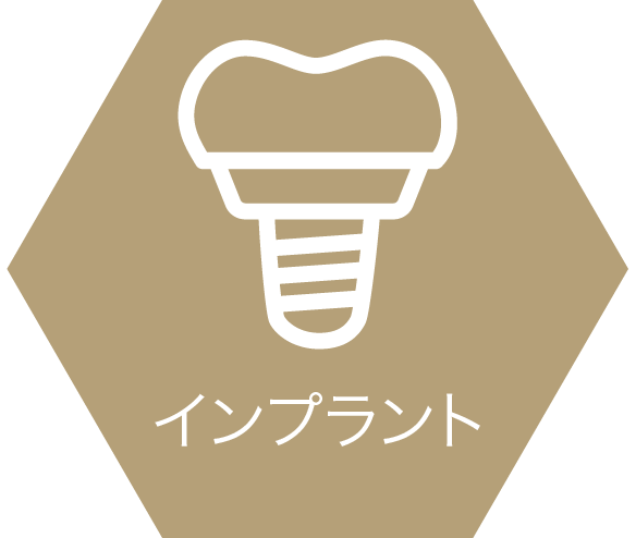 インプラント